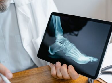 Recuperação após fratura instável